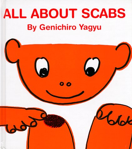 All about scabs Cover
