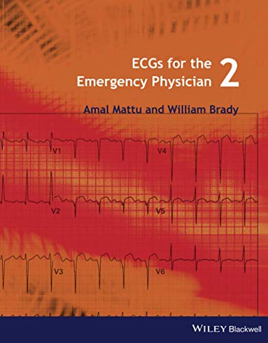 Ecgs for the Emergency Physician Cover