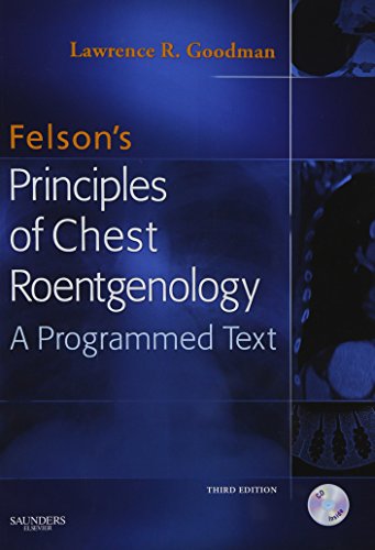 Felson's principles of chest roentgenology. Cover