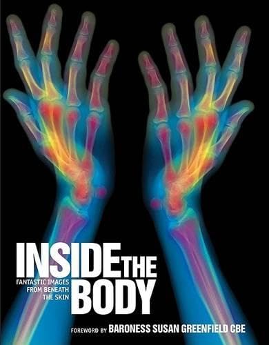 Inside the Body Cover